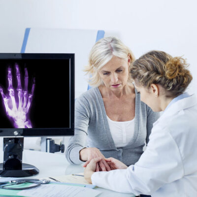 Arthritis – Types and early warning signs