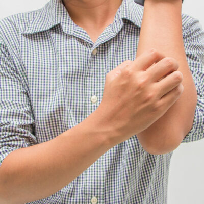 10 warning signs of eczema to watch out for