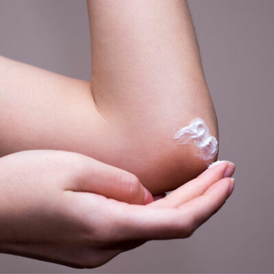 Top 7 topical lotions for managing eczema flareups